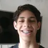 kaykediaser