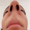 adelletoe