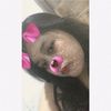 septi.cntip