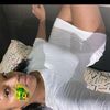 noe_ca1