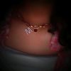 mitz_lqv