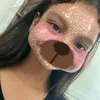 chinkatalbas