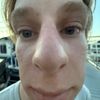 spastqic