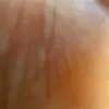 melmus2