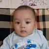 sonnguytreation
