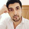 nemet_nn