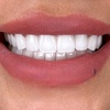 Hollywood Smile Clinic