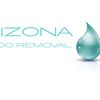 arizonatattooremoval