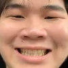 minkankngoidayckoem
