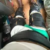 legbrace_guy