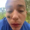 skittaletzz