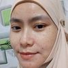 moms_abietata