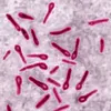 clostridium_tetani_