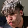 samu_192_ambulancia