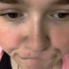 starr_dumm