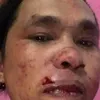 braizetagg