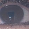 stoneysupreme_1