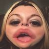 raeroll