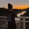 adolescentecalva