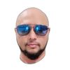 Abg Botak