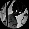 blnddoski084