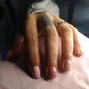 delsoalmi