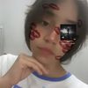 una_mvnor