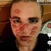 ziccaserena