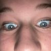 fmbzyt