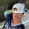 Austin Lip