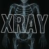 h900xray