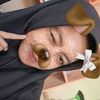 xxy_ferr