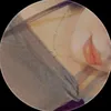 l6na.17