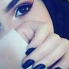 mirna1398