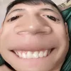 dycantho