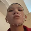 rashes_morales