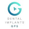 Dental Implants GPS