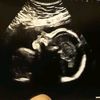 alexisgoodlett199
