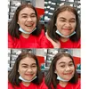 _kepitengsunge