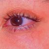 sunbr_heart