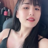 phuongthuy_filler_botox