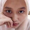 kiacinamide