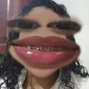 imylenx