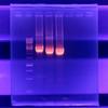 gel_electrophoresi