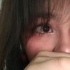 ann_balt