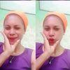 tinha_2307