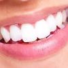 teeth.brightornot