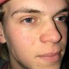 jacob_heberlie