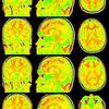 drainthebrain87