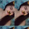 xrhinz